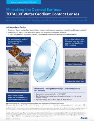 Mimicking the Corneal Surface: TOTAL30® Water Gradient Contact Lenses